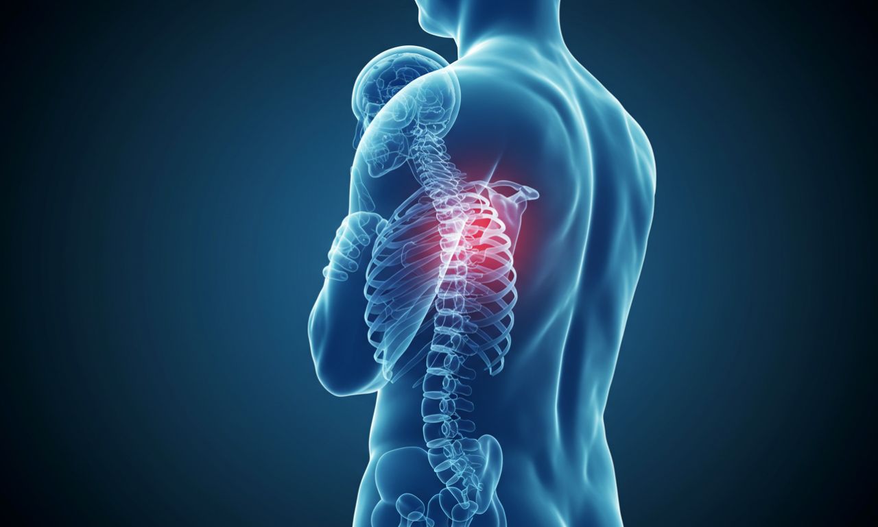 Inomyalgia: Symptoms, Diagnosis, and Treatment Options